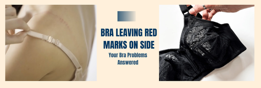 bra leaving red marks